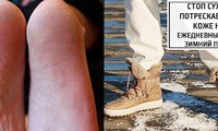 Стоп сухой и потрескавшейся коже ног: ежедневный уход в зимний период