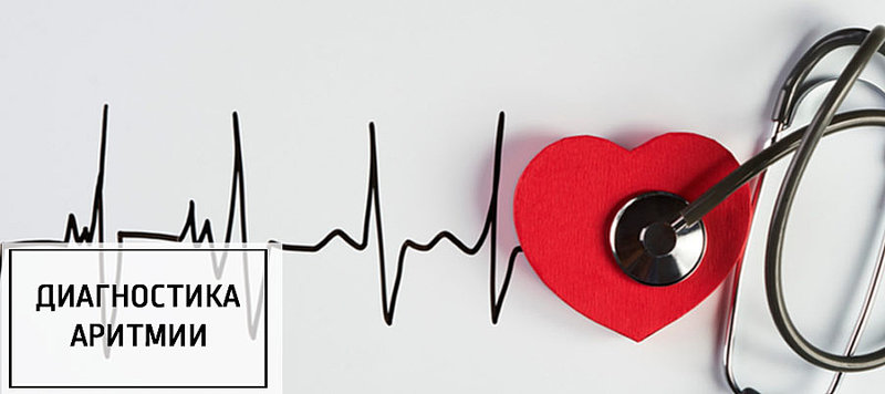 Диагностика аритмии: как распознать нарушение ритма сердца