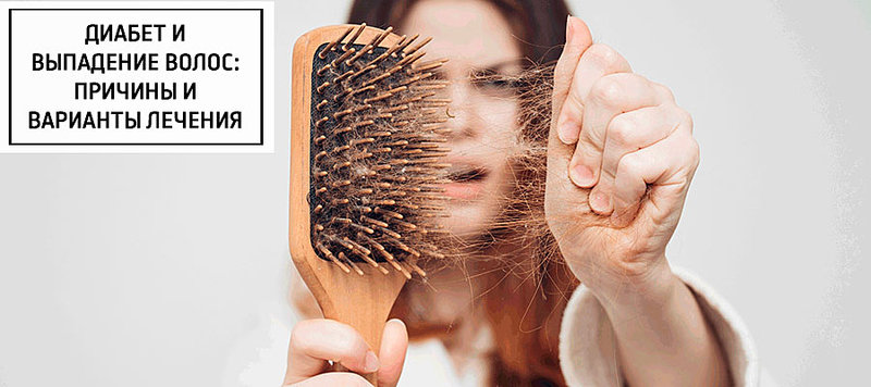 Диабет и выпадение волос: причины и варианты лечения